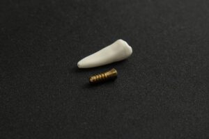 closeup of screw for dental implant 2022 05 09 23 36 21 utc 2