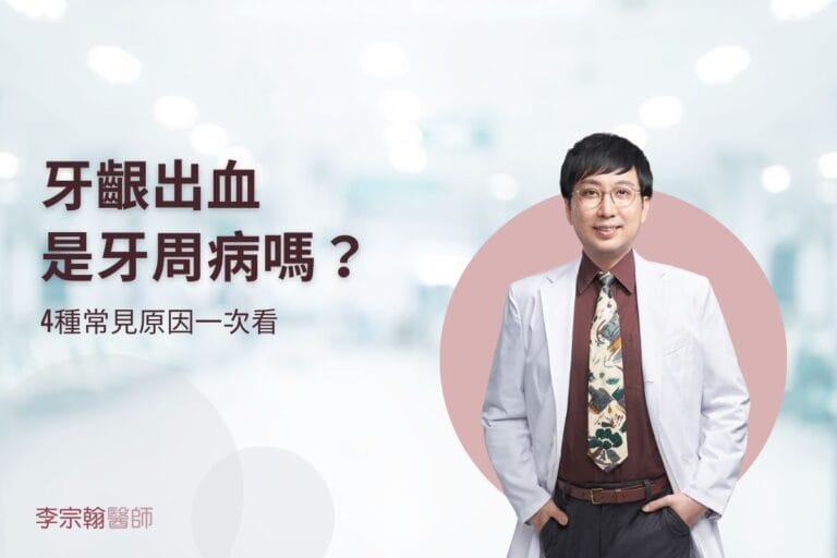 最新消息 1 牙齦出血是牙周病嗎?4種常見原因一次看