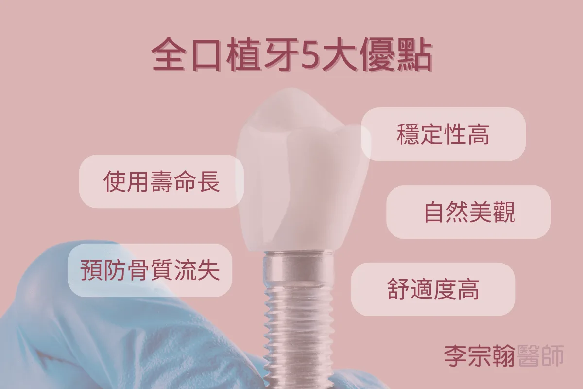 全口植牙全解析:適合對象、治療流程與優缺點全面剖析 4 全口植牙優點有哪些?