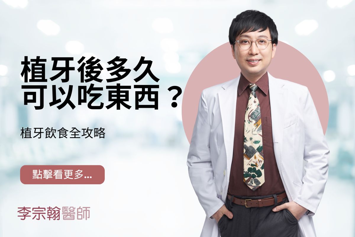 Read more about the article 植牙後多久可以吃東西？植牙飲食全攻略