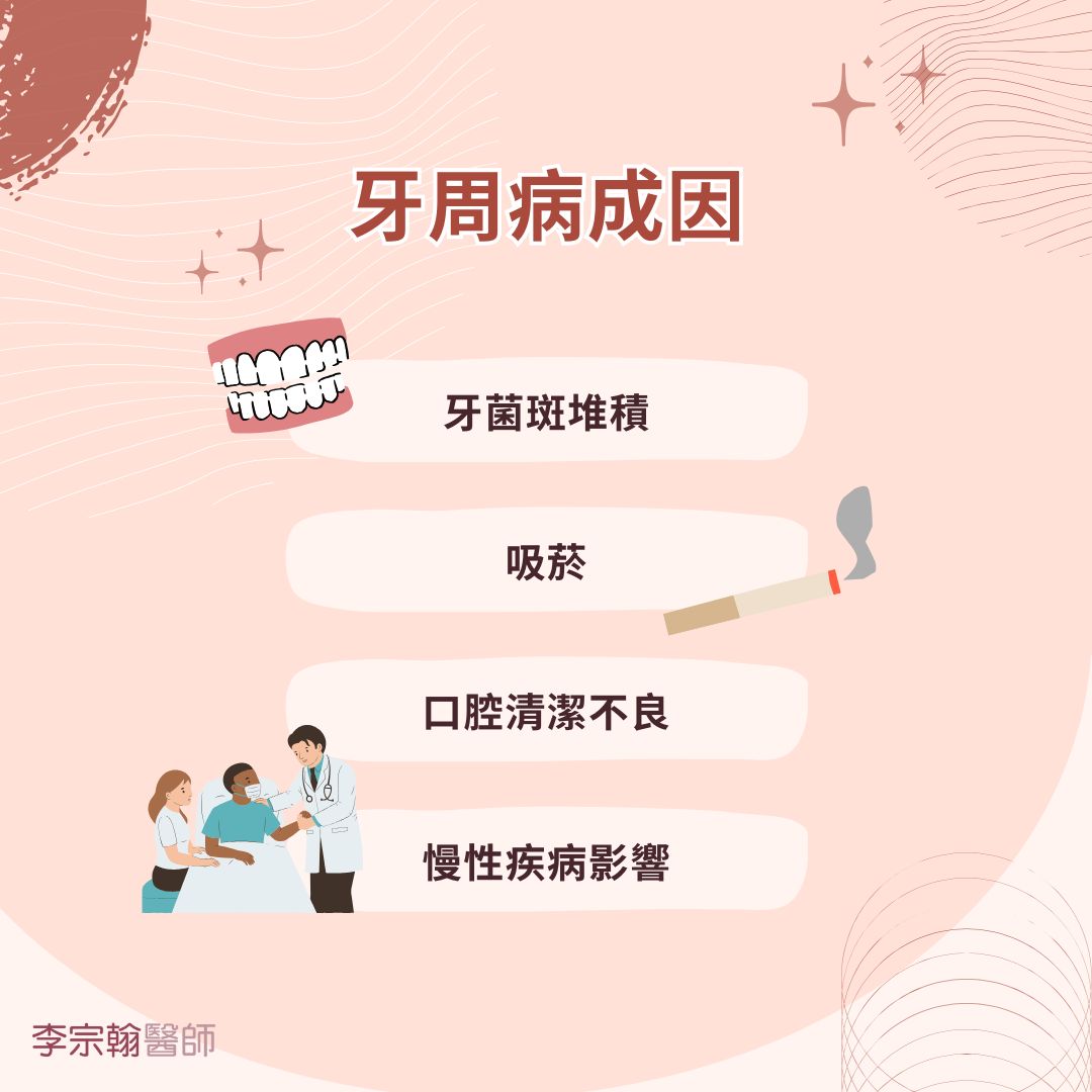 從根源改善牙周病口臭治療問題,打造健康清新口氣 1 牙周病成因