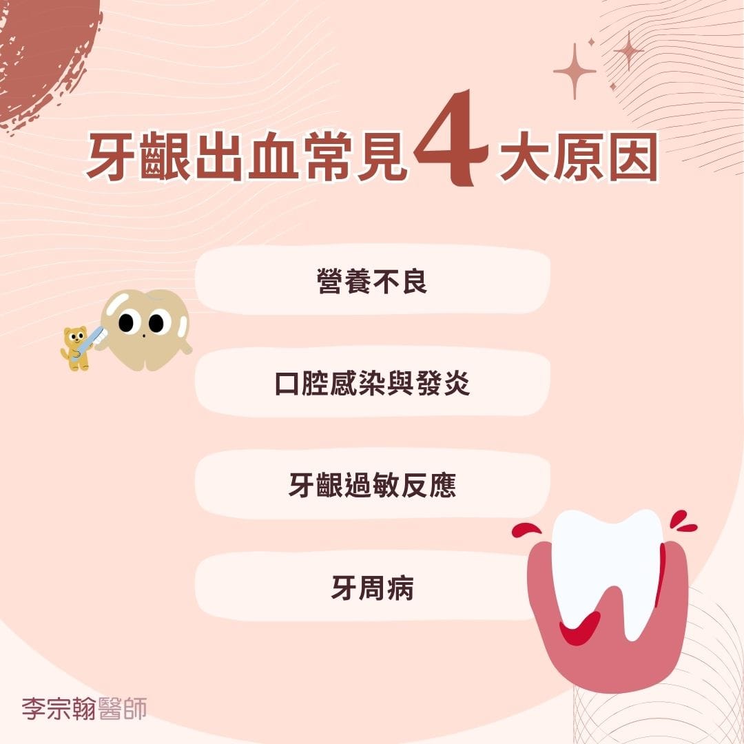 牙齦出血是牙周病嗎?4種常見原因一次看 1 牙齦出血常見4大原因